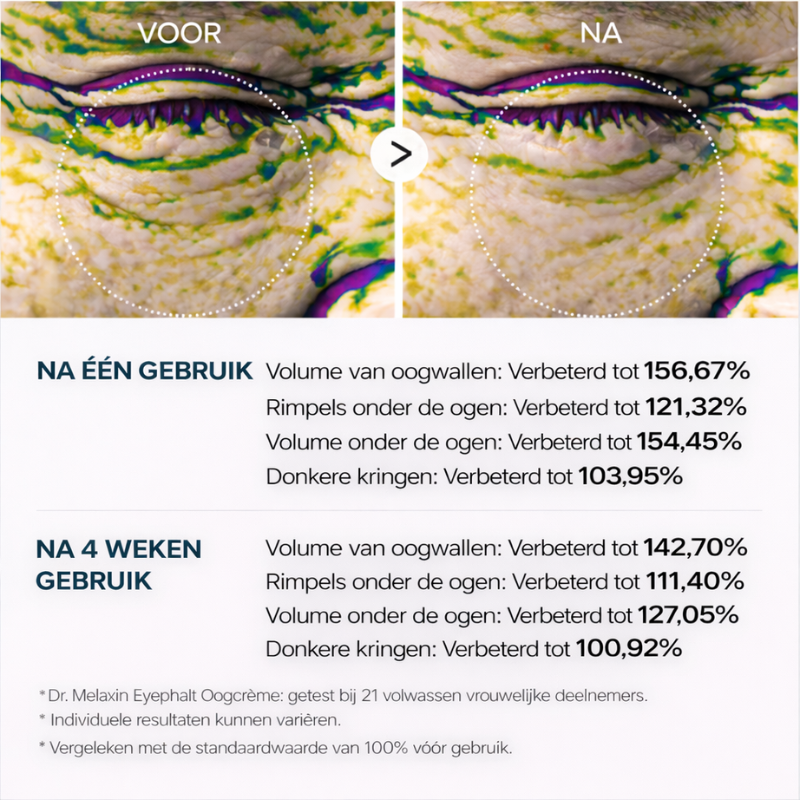 Dr. Melaxin – Eye Lift Cream | Vermindert Wallen met Liftend Effect