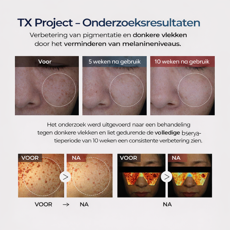 Dr. Melaxin – Pigment Correcting Cream | vermindert Donkere vlekken