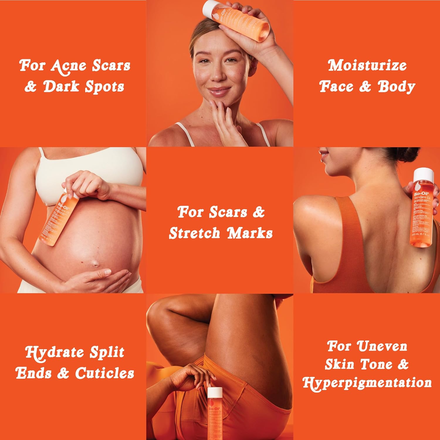 Bio-Oil - Hydratatie en verzorging van littekens en striemen