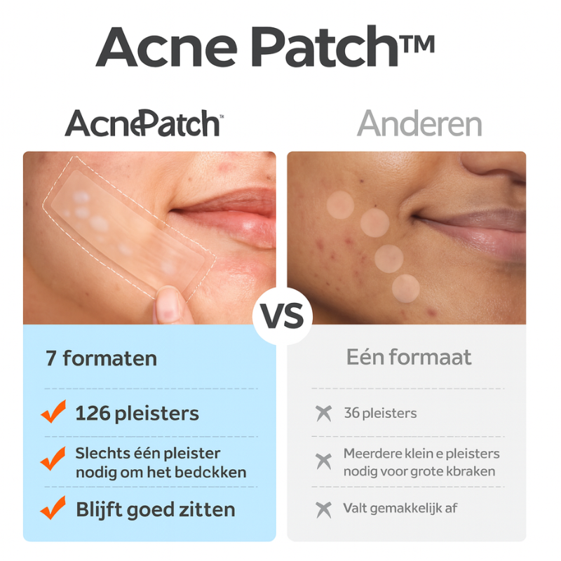 Luneo – Acne Patch Variety Pack | 126 stuks tegen puistjes en acne